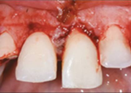 Hopital befelatanana