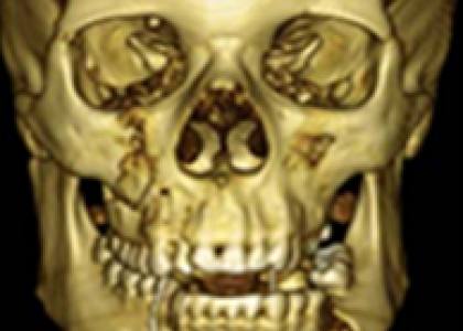 Hopital befelatanana