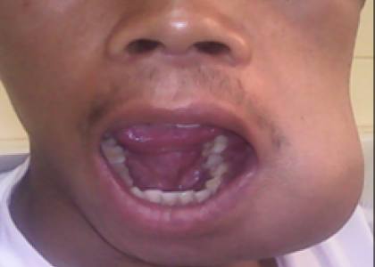 Hopital befelatanana