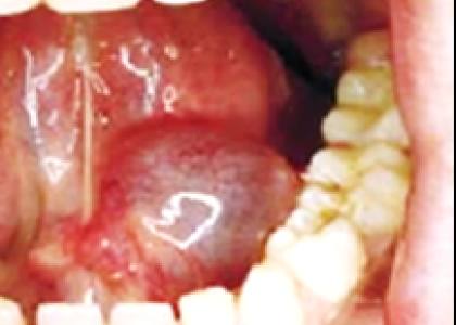 Hopital befelatanana