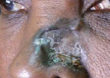 Hopital befelatanana