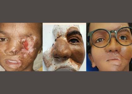 Stomatologie befelatanana